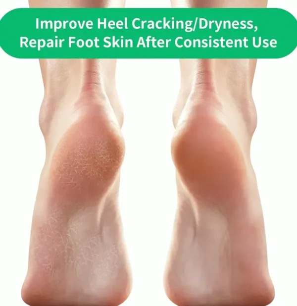 Heel Care Healing Stockings - Brand 5Pack Moisturizing Stockings