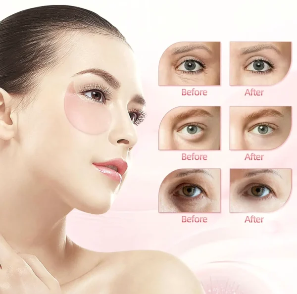 Refreshing Under Eye Patches (30 Count), for Puffy Eyes
