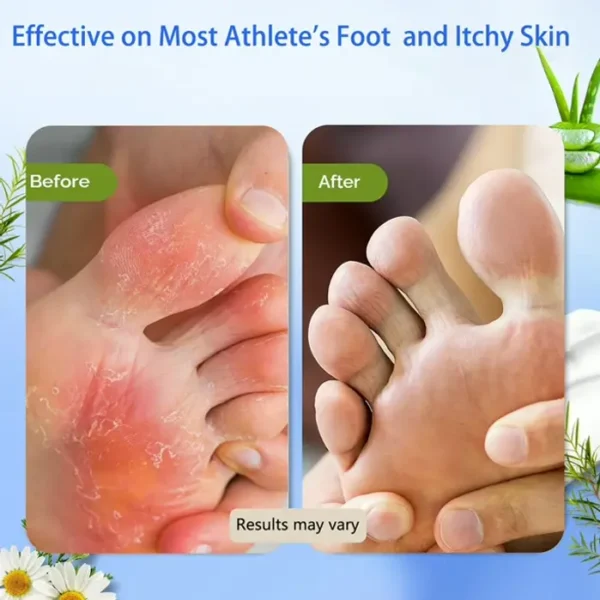 Relieving Foot Cream for Parched Feet