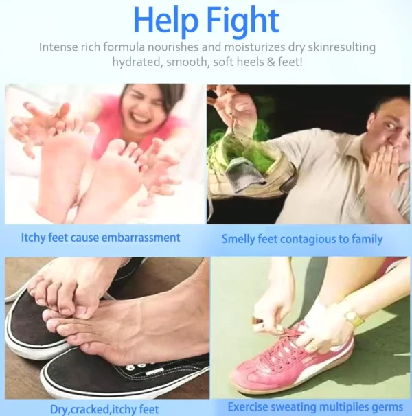 Relieving Foot Cream for Parched Feet