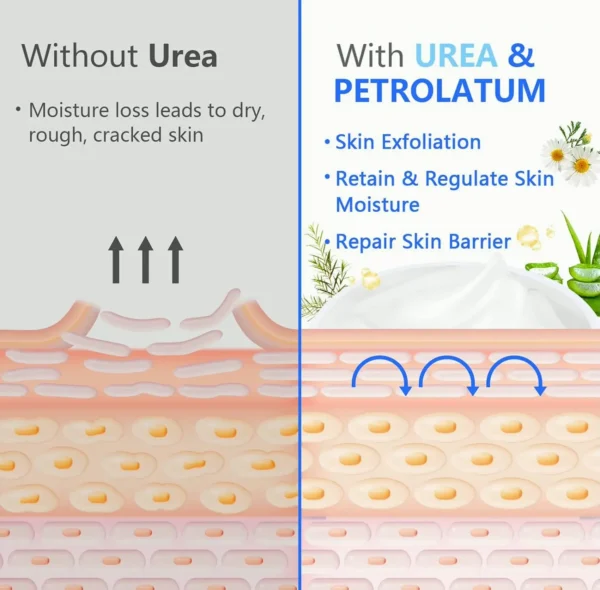 Relieving Foot Cream for Parched Feet