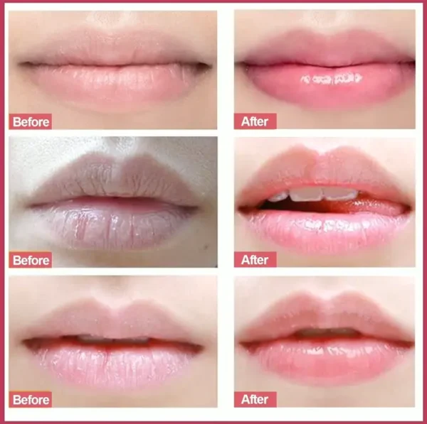 Lip Treatment Exfoliator, Natural Polish for Dry Skin