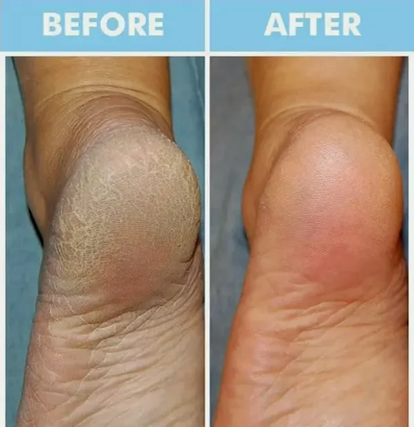 Top Hand and Feet Mask Pack | Moisturizing Handwear & Footwear