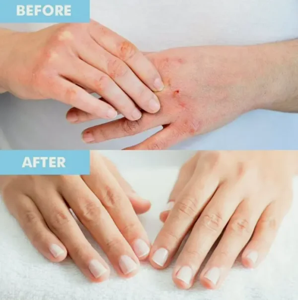 Top Hand and Feet Mask Pack | Moisturizing Handwear & Footwear
