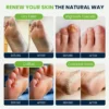 Tea-Tree Foot Soak for Nail Repair