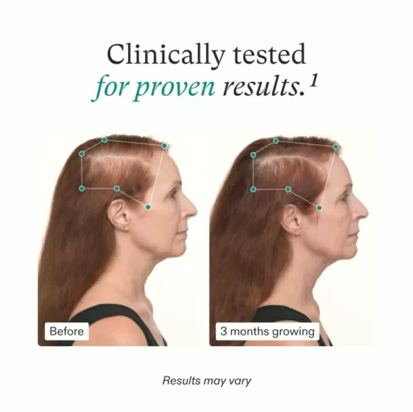 Women's Hair Growth Supplements for 45 and Up - Monthly