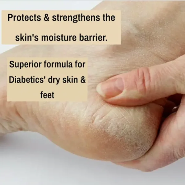Greyfeather Crack Attack Hand and Foot Cream, Skin Care Therapy (4 Oz)